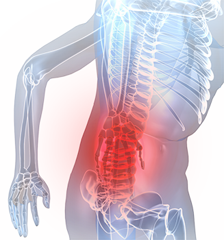 Automobile Accident Spinal Cord Injuries | Boca Raton Spine Center